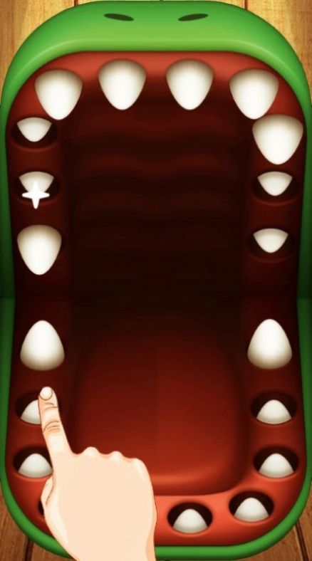 鳄鱼牙医挑战v1.04