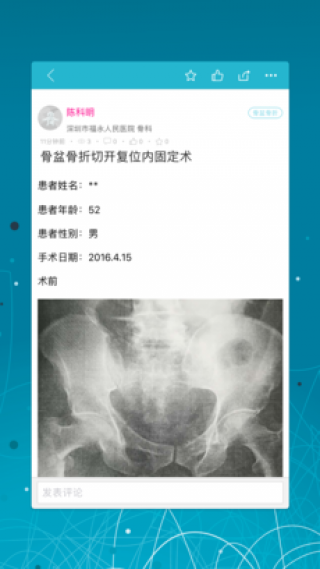 论桥接骨v1.0.0